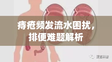 痔疮频发流水困扰，排便难题解析
